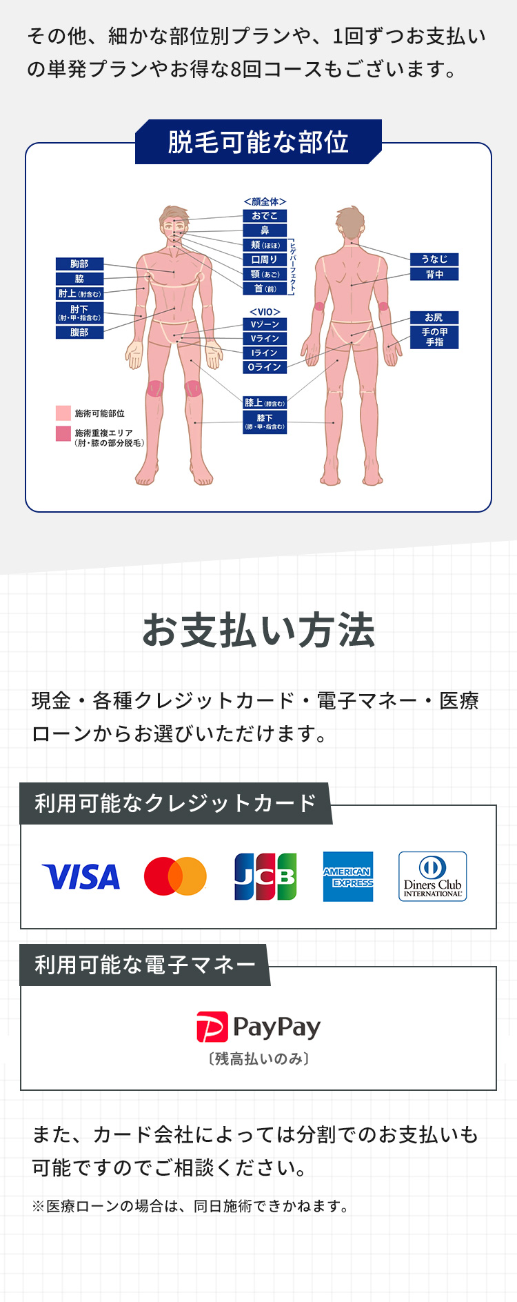 スカイなら都度払いもOK！